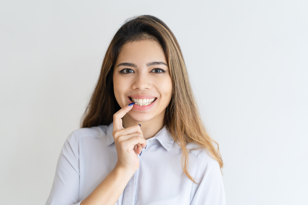The Benefits of Invisalign for Upper Teeth